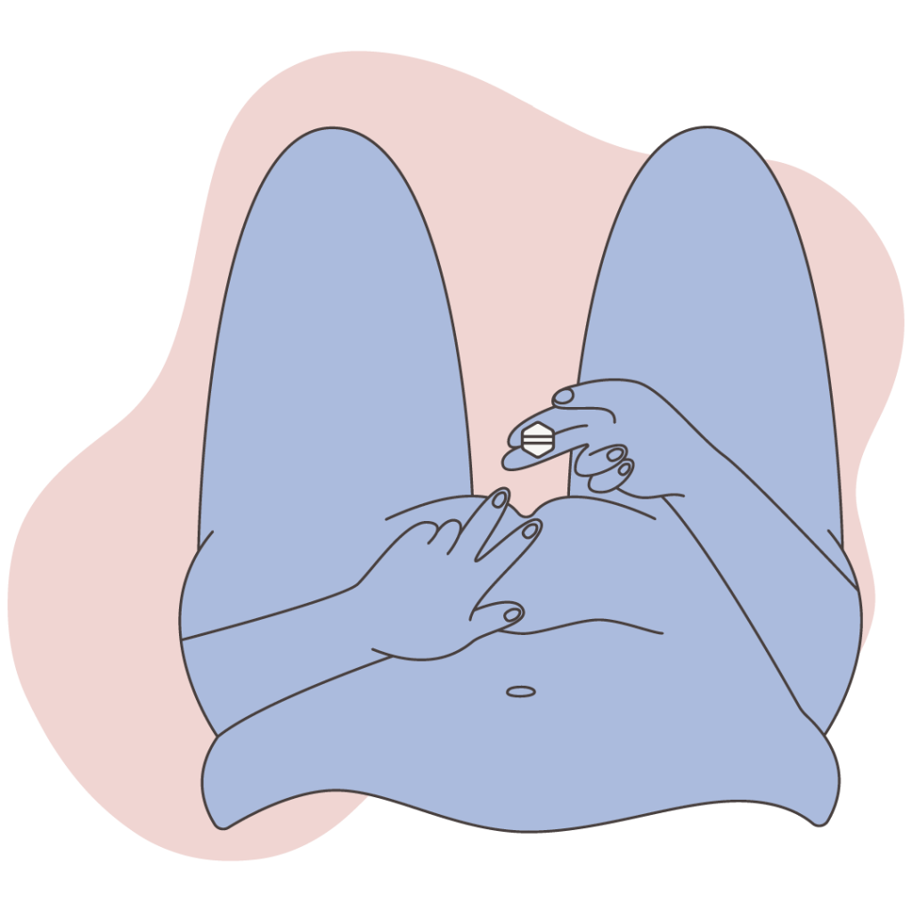 Illustration of vaginal insertion of an abortion pill